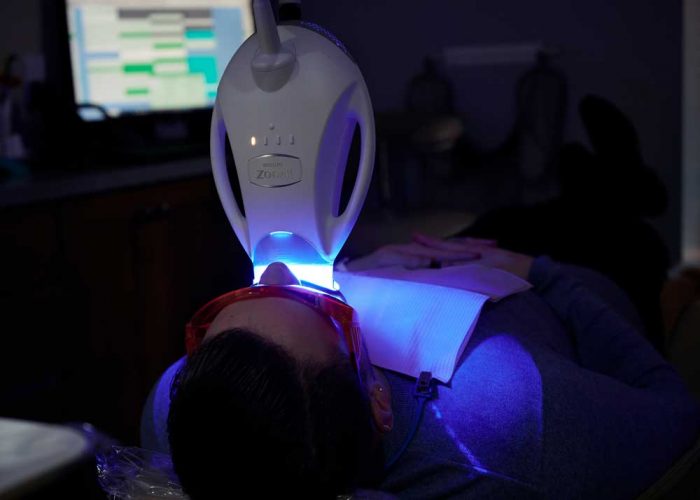 Teeth Whitening in Salt Lake City, UT Whiter and Brighter Smiles