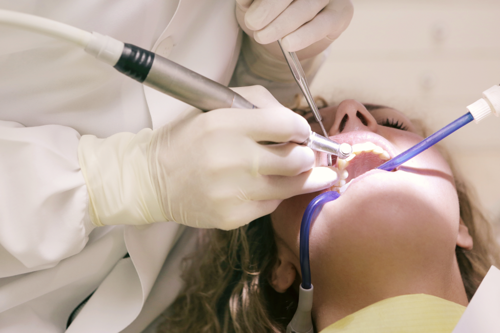Enhance Your Smile: Unveiling the Secrets of Professional Teeth Whitening in Salt Lake City, Utah