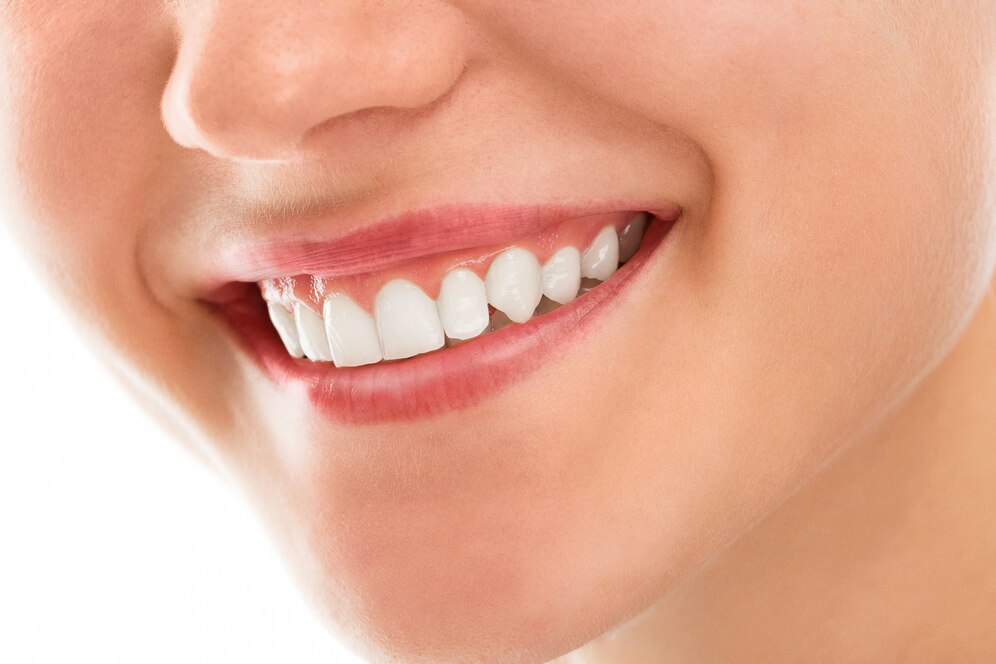 Achieve Your Brightest Smile with Salt Lake City's Teeth Whitening Services